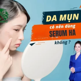 Serum Ha Có Dùng Được Cho Da Mụn Không