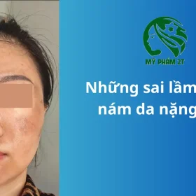 Những sai lầm khiến nám da ngày càng nghiêm trọng
