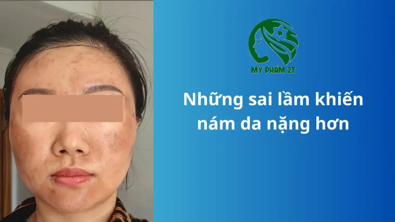 Những Sai Lầm Khiến Nám Da Ngày Càng Nghiêm Trọng