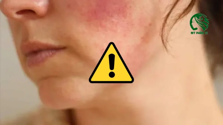 Sai Lầm Khi Thải Corticoid Da Thường Gặp