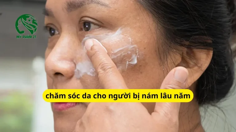 Chăm Sóc Da Cho Người Bị Nám Lâu Năm Đúng Cách, Cải Thiện Rõ Rệt