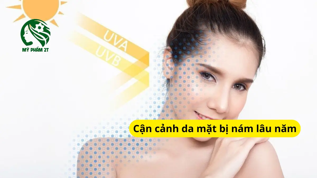 chống nắng cho da nám lâu năm