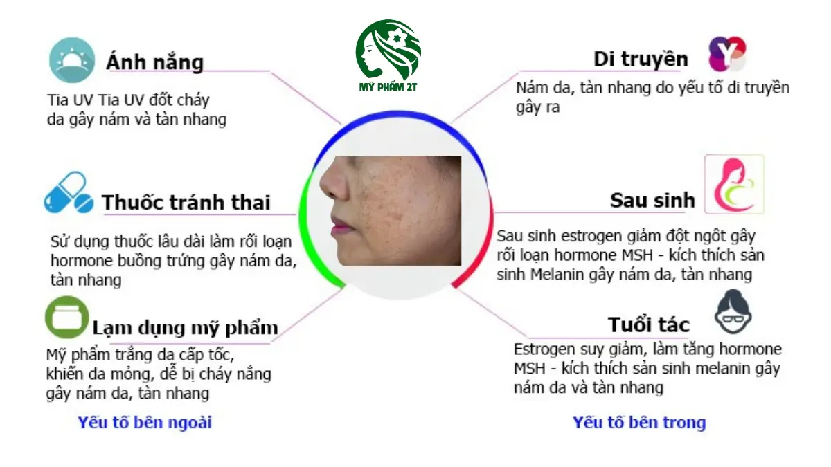Nhận biết nguyên nhân gây nám da