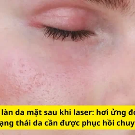 Kem Phục Hồi Tốt Cho Da Sau Laser