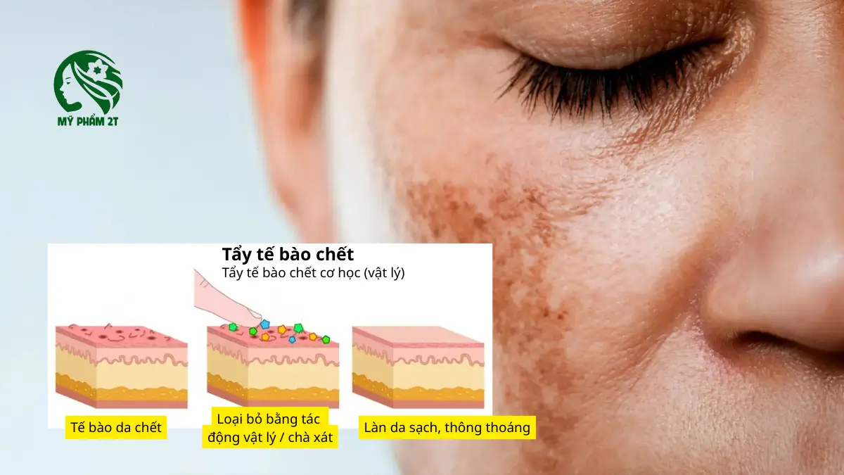 Tại sao tẩy tế bào chết quan trọng trong điều trị nám