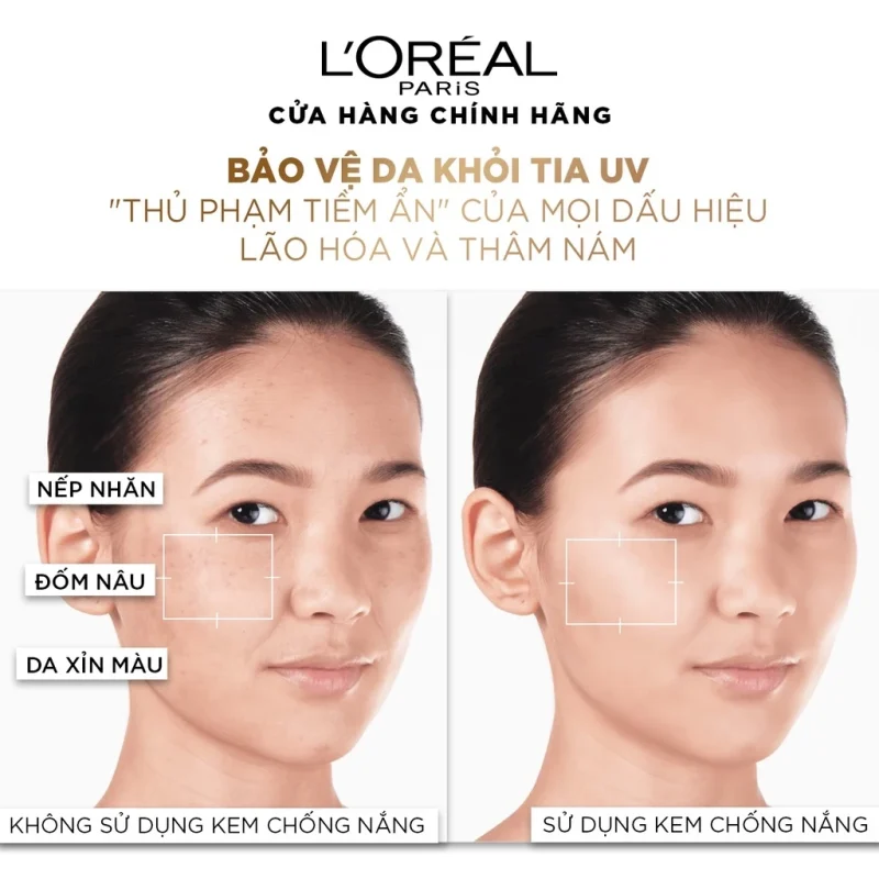 So Sánh Hiệu Quả Bảo Vệ Da Khỏi Thâm Nám Và Lão Hóa Khi Sử Dụng Kem Chống Nắng L'Oreal.