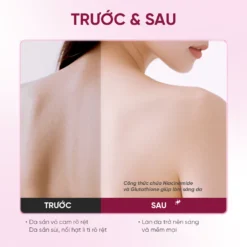 Review Trước Và Sau Khi Dùng Sữa Tắm Grace And Glow Body Wash – Da Sáng Mịn Rõ Rệt