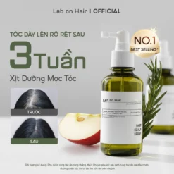 Tóc Dày Lên Rõ Rệt Sau 3 Tuần Sử Dụng Xịt Dưỡng Mọc Tóc Lab On Hair