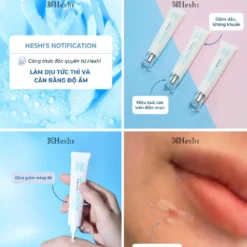 Gel Chấm Mụn Heshi Acnes Gel – Làm Dịu Tức Thì, Giảm Sưng Đỏ, Kháng Khuẩn Hiệu Quả