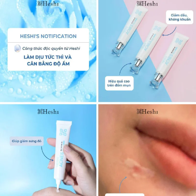 Gel Chấm Mụn Heshi Acnes Gel – Làm Dịu Tức Thì, Giảm Sưng Đỏ, Kháng Khuẩn Hiệu Quả
