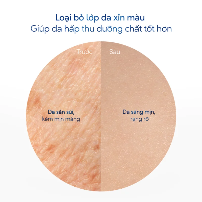 So Sánh Bề Mặt Da Trước Và Sau Khi Sử Dụng Tẩy Tế Bào Chết Dove
