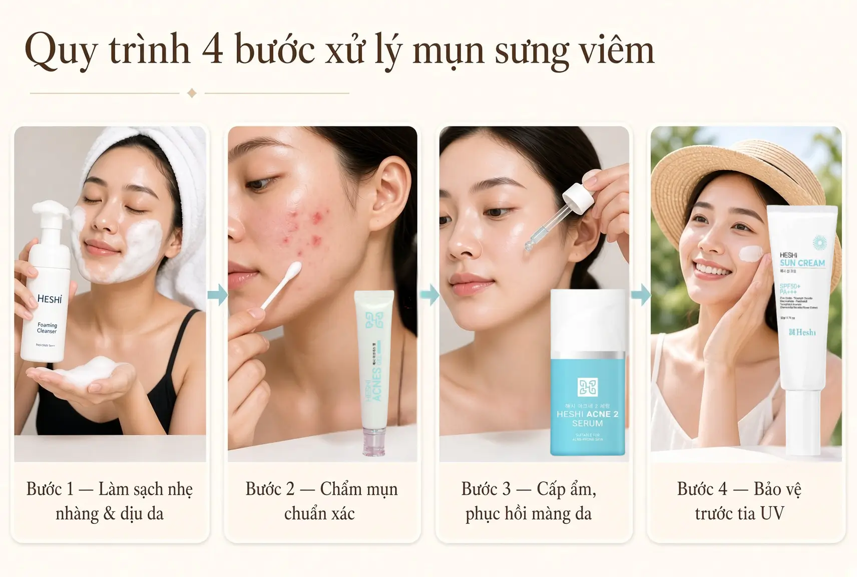 Cách Làm Dịu Và Xử Lý Mụn Sưng Viêm An Toàn Chuẩn Y Khoa 5 Grid Ảnh 4 Bước Chăm Sóc Da Mụn Sưng Viêm: Làm Sạch, Chấm Mụn, Phục Hồi, Chống Nắng.