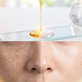 Cải Thiện Làn Da Thâm Sạm Nhờ Áp Dụng Cách Kết Hợp Vitamin C Và Niacinamide Chuẩn Y Khoa