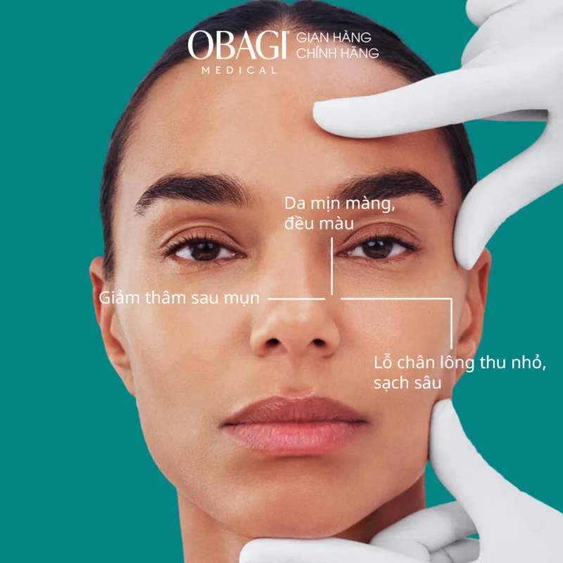 Toner Bha Giảm Mụn Obagi Có Tốt Không? Review Chi Tiết 2 Toner Bha Obagi Hỗ Trợ Da Mịn, Giảm Thâm Sau Mụn Và Làm Sạch Lỗ Chân Lông