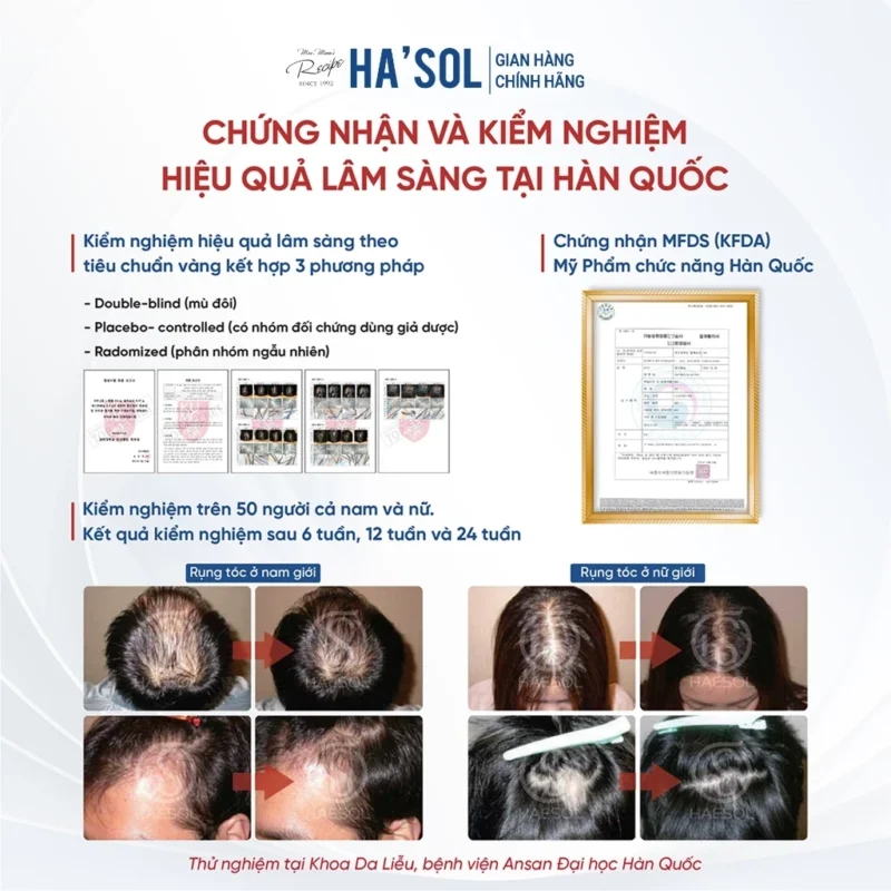Đánh Giá Chuyên Sâu Hasol Anagen Active Tonic: &Quot;Đòn Bẩy&Quot; Nào Cho Mái Tóc Thưa Rụng? 8 Kết Quả Kiểm Nghiệm Lâm Sàng Của Ha'Sol Anagen Active Tonic Tại Hàn Quốc, Bao Gồm Hình Ảnh Trước Và Sau Khi Sử Dụng Của Nam Và Nữ Sau 6, 12 Và 24 Tuần, Cùng Giấy Chứng Nhận Mfds.