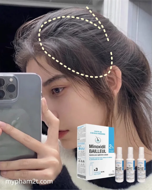 Review Hiệu Quả Thực Tế Xịt Mọc Tóc Minoxidil Bailleul 2% Cho Nữ Giới