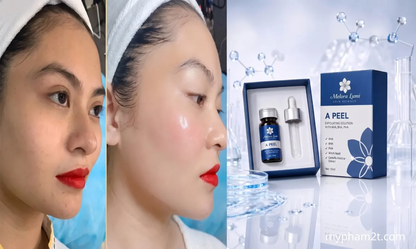 A Peel Melora Lumi 10Ml Tinh Chất Peel Da Tái Tạo &Amp; Rạng Rỡ 7 So Sánh Làn Da Sần Sùi Và Mịn Màng Căng Bóng Sau Liệu Trình Thay Da Melora Lumi A Peel