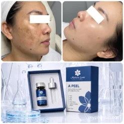 A Peel Melora Lumi 10Ml  Tinh Chất Peel Da Tái Tạo &Amp; Rạng Rỡ  Ảnh 3