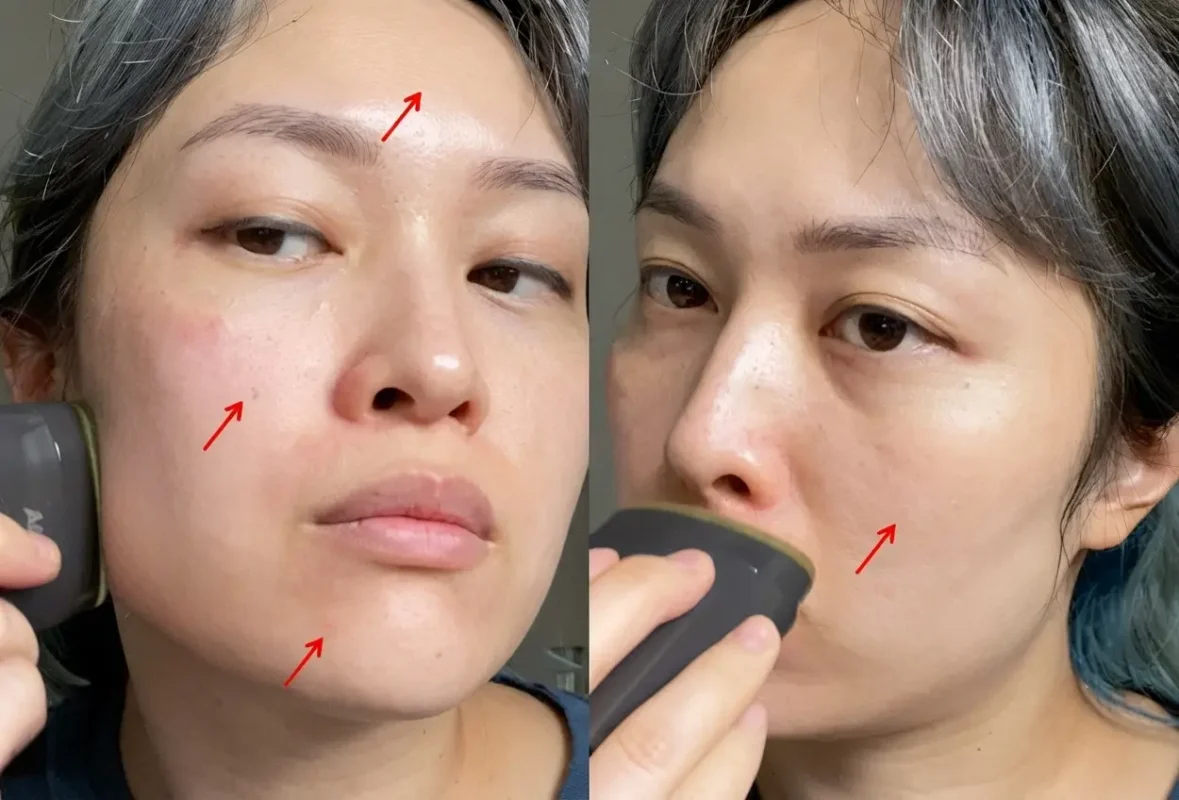Cách Bôi Kem Chống Nắng Dạng Thỏi Cho Đủ Spf Michelle Wong 4 Chỗ Dễ Sót Khi Quẹt Thỏi Chống Nắng: Trán, Má, Cằm
