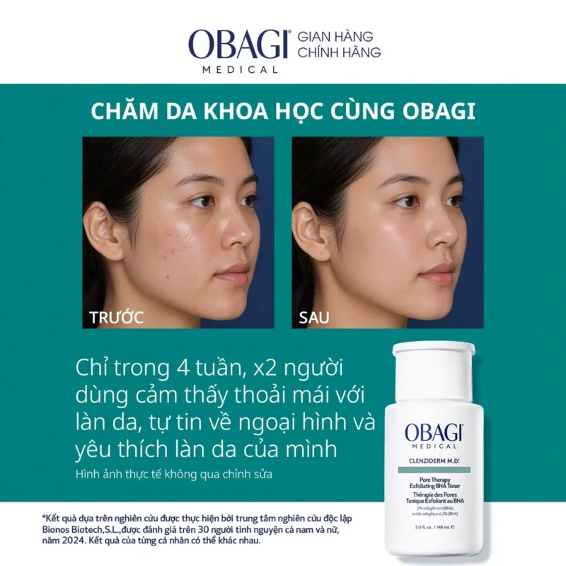 Toner Bha Giảm Mụn Obagi Có Tốt Không? Review Chi Tiết 5 Da Trước Và Sau Khi Dùng Toner Bha Obagi Trong Liệu Trình Chăm Sóc Mụn