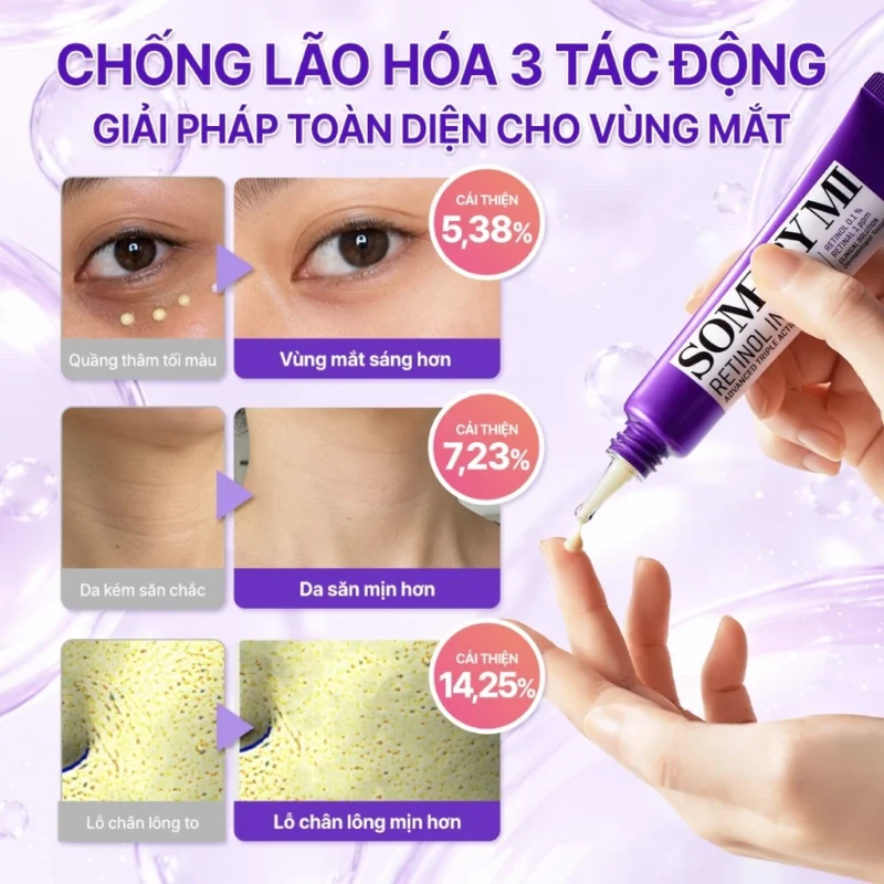 Hình Ảnh Trước Và Sau Khi Dùng Kem Mắt Some By Mi Trên Vùng Quầng Thâm, Nếp Nhăn Cổ Và Lỗ Chân Lông