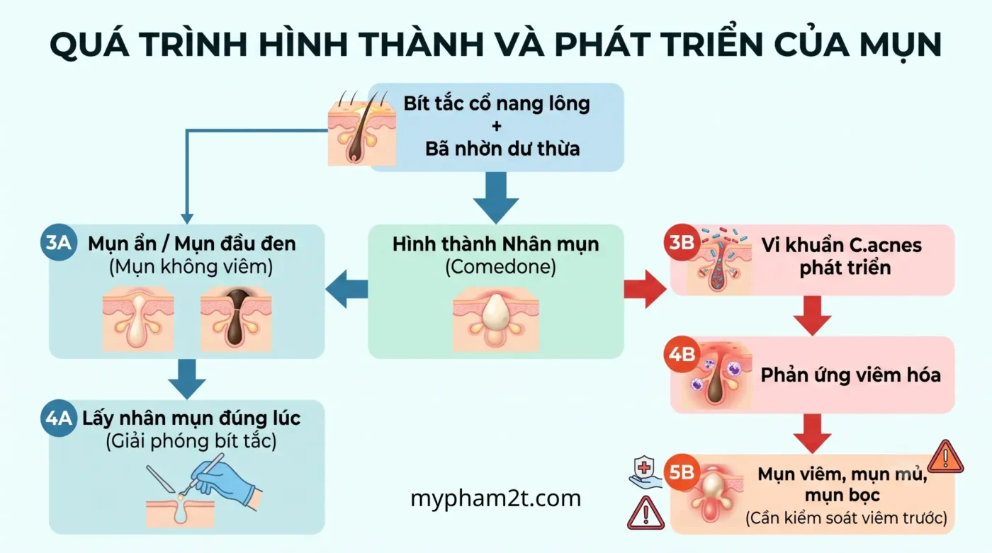 Phác Đồ Lấy Nhân Mụn Chuẩn Y Khoa Hạn Chế Thâm Sẹo Cho Spa 1 Qua Trình Hình Thành Và Phát Triển Của Mụn